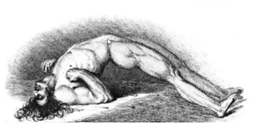 Science by a Scientist: On Tetanus
