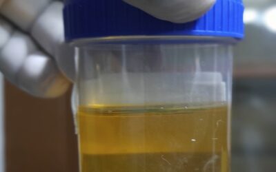 Teaching Tales: About Pee