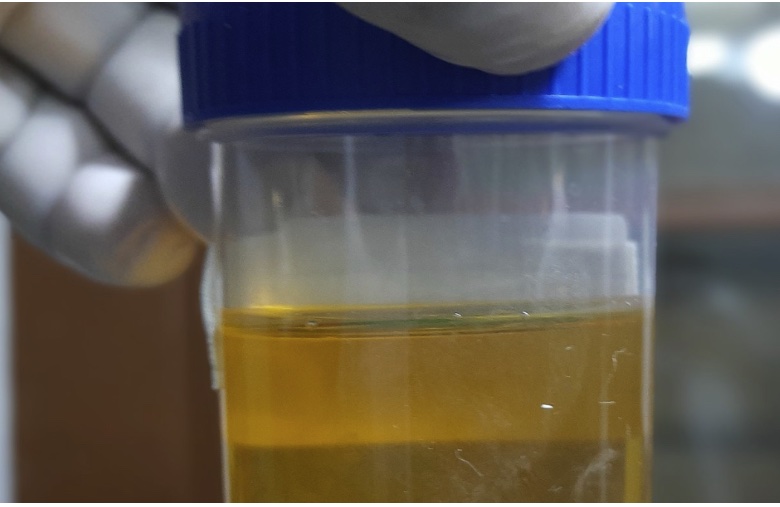 Teaching Tales: About Pee